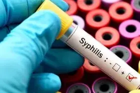 Resurging Syphilis: A Global Health Concern and Exploring NMN for Immune System Support