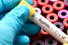 Resurging Syphilis: A Global Health Concern and Exploring NMN for Immune System Support