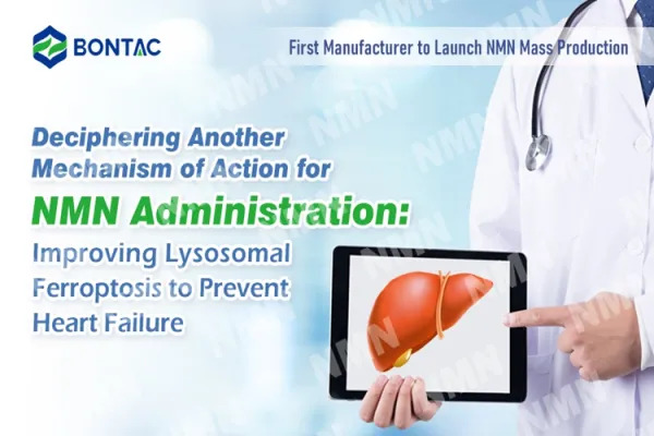 Deciphering Another Mechanism of Action for NMN Administration: Improving Lysosomal Ferroptosis to Prevent Heart Failure