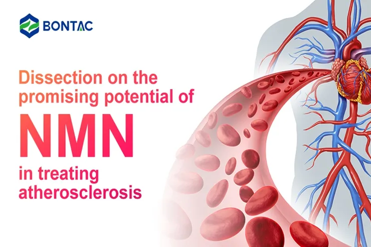 Dissection on the promising potential of NMN in treating atherosclerosis