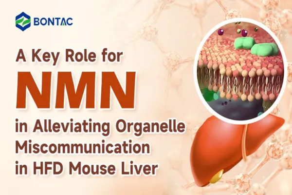 A Key Role for NMN in Alleviating Organelle Miscommunication in HFD Mouse Liver