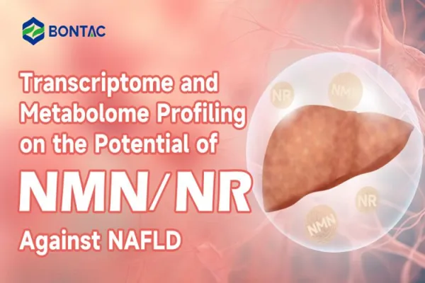 Transkriptom- och metabolomprofilering av potentialen hos NMN/NR mot NAFLD