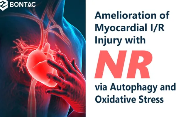 Amelioration of Myocardial I/R Injury with NR via Autophagy and Oxidative Stress