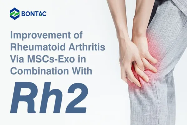 Improvement of Rheumatoid Arthritis Via MSCs-Exo in Combination With Rh2