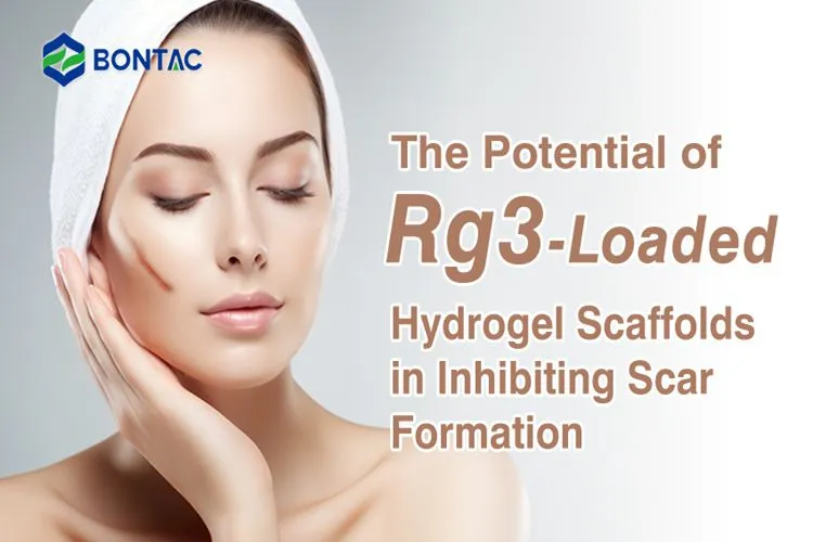 The Potential of Rg3-Loaded Hydrogel Scaffolds in Inhibiting Scar Formation Introduction